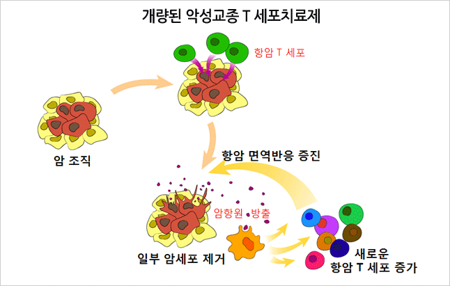 개량된 악성교종 T 세포치료제 : 암조지 - 항암 T세포 - 항암 면역반응 증진 - 일부 암세포 제거 - 새로운 항암 T 세포 증가