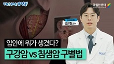갑상선암센터 김정현 교수 입안에 뭐가 생겼다? 구강암vs침샘암 구별법
